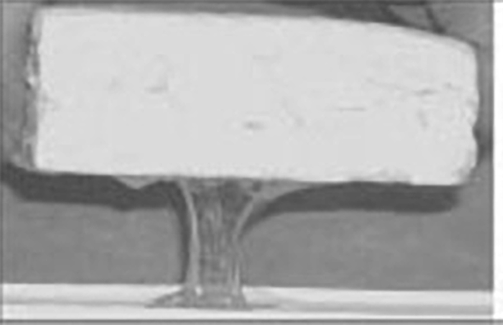 ΠΡΩΤΟΣΕΛΙΔΟ - Βλεννώδης Επιφάνεια ή Μύξιασμα της άλμης - Τί θα πρέπει να ξέρω?